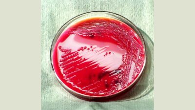 Shigella cases rise in Kerala; death toll reaches 6