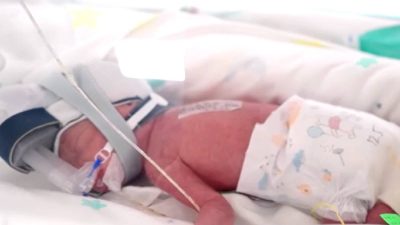 Australian woman welcomes 'one in 15 million' identical quadruplet girls